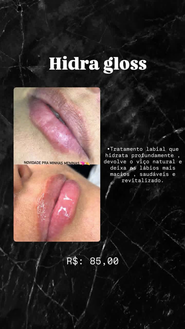 Hidra Gloss